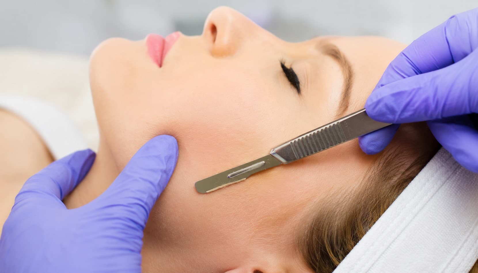 Dermaplaning